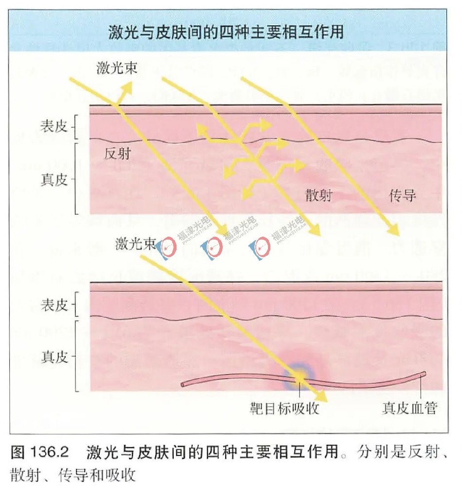 激光与皮肤